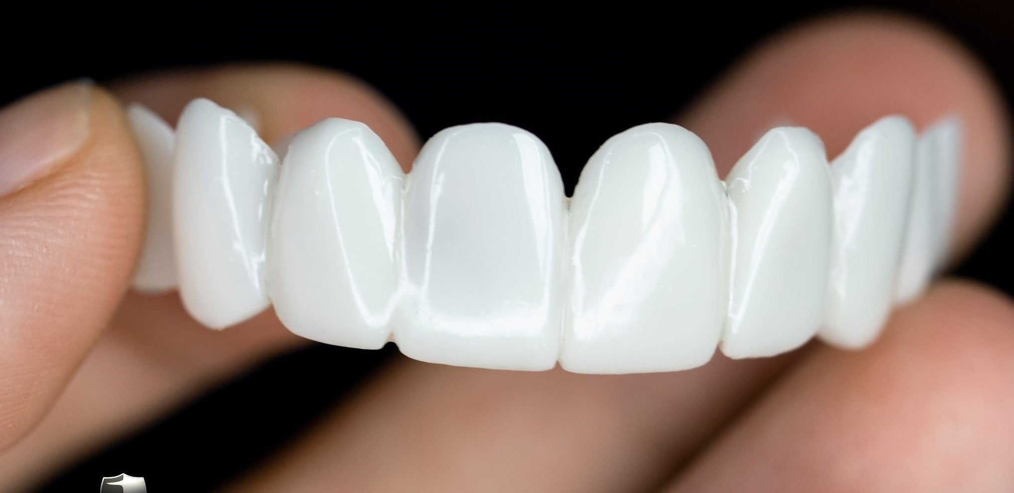 Snap-On Cosmetic Teeth Veneers for Covering Gaps, Stains & Missing Teeth – Reusable Smile Enhancement for Daily Confidence & Special Events | Thomler