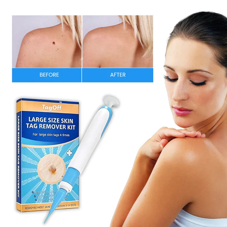 Skin Tag Remover Serum for Face Neck Body | Gentle Topical Treatment for Unwanted Skin Tags Fast Acting Formula | Works on Armpits Arms | Thomler