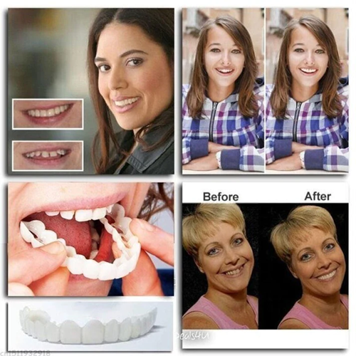 Cosmetic Tooth Veneer Snap-On Cover – Adjustable Fit for Natural-Looking Smile, Removable & Reusable Temporary Smile Enhancement | Thomler