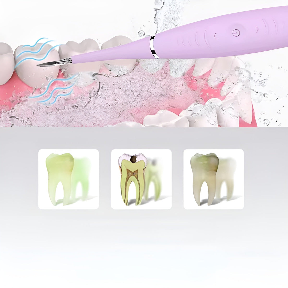 Sonic Plaque Remover for Home Teeth Cleaning & Stain Reduction | Thomler