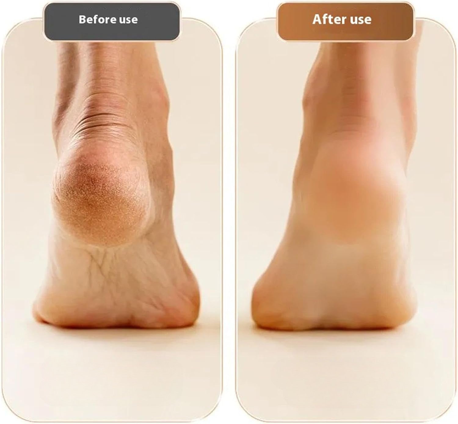 Rechargeable Foot File for Dead Skin & Rough Heels | Professional Pedicure Tool for Smooth Feet at Home | Thomler