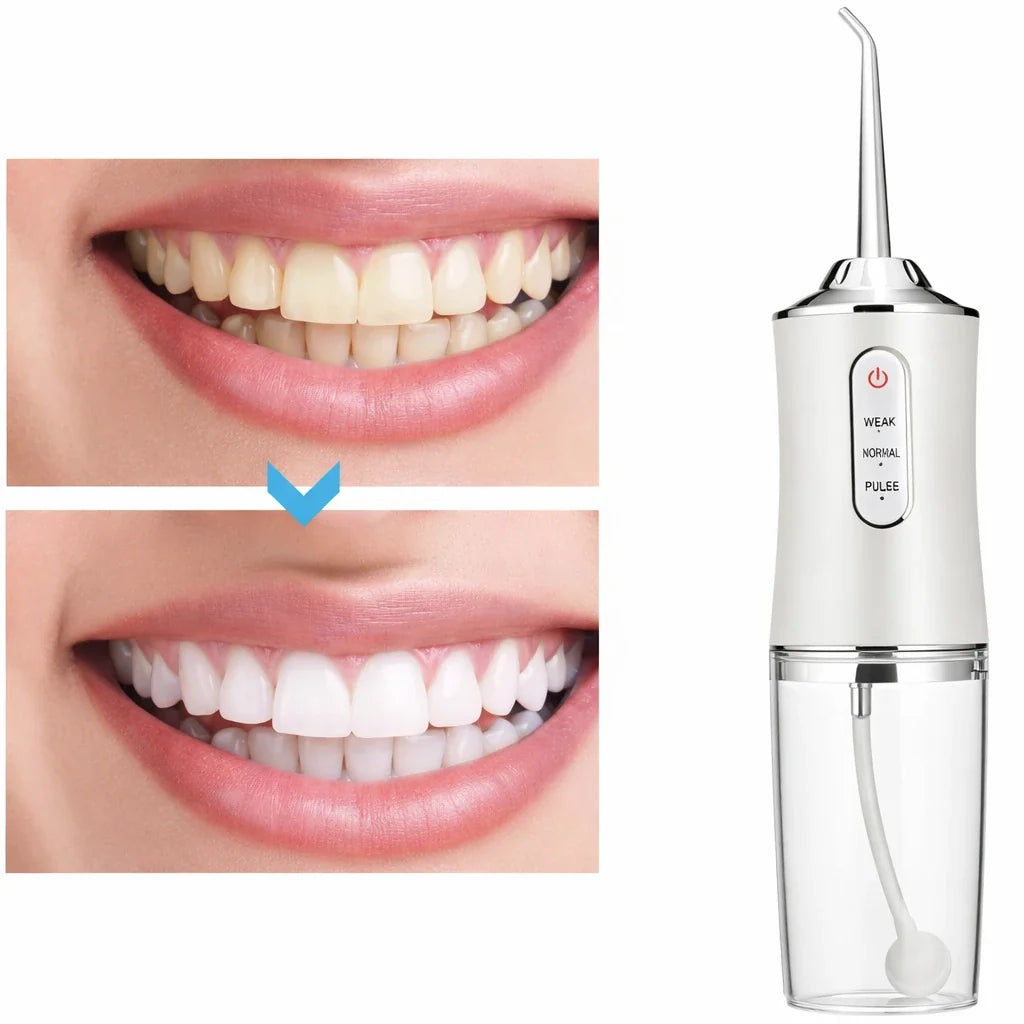 Cordless Water Flosser with 3 Pressure Modes for Travel & Home – Rechargeable Dental Irrigator for Braces, Gums & Deep Cleaning | Thomler