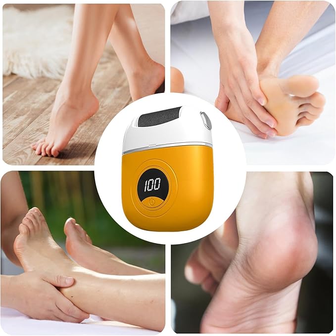 Rechargeable Foot File for Dead Skin & Rough Heels | Professional Pedicure Tool for Smooth Feet at Home | Thomler