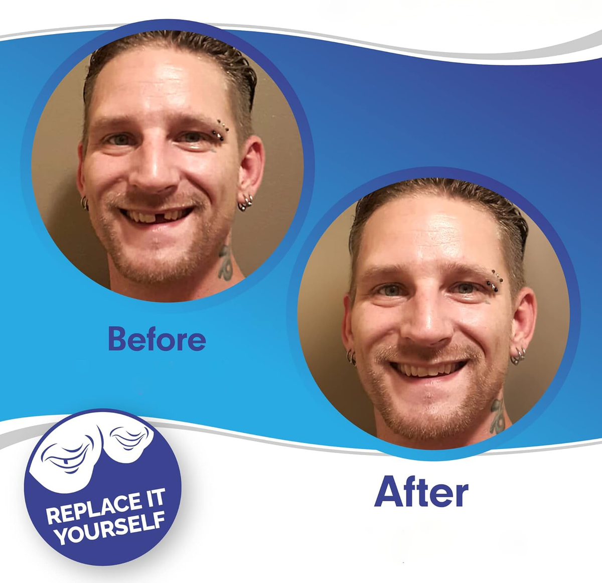 Cosmetic Tooth Covers Upper & Lower Set Instant Snap-On Dental Overlay for Natural Looking Smile Confidence Booster Reusable Teeth Caps | Thomler