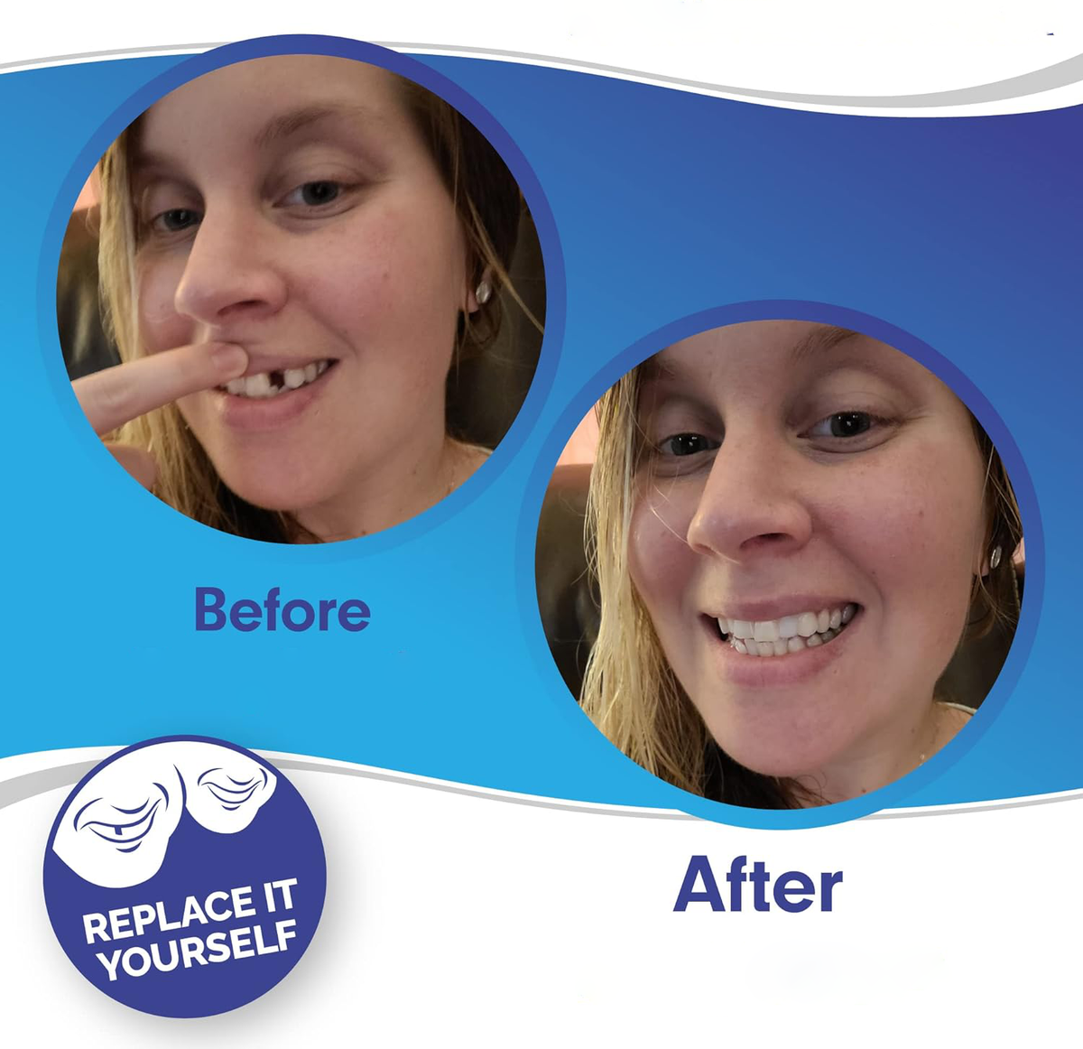 Cosmetic Tooth Covers Upper & Lower Set Instant Snap-On Dental Overlay for Natural Looking Smile Confidence Booster Reusable Teeth Caps | Thomler