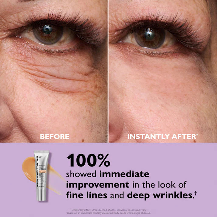 Under Eye Cream for Dark Circles and Wrinkles Instant Lift Brightening Treatment Anti-Aging Makeup Primer for Women Men Face Eyes | Thomler