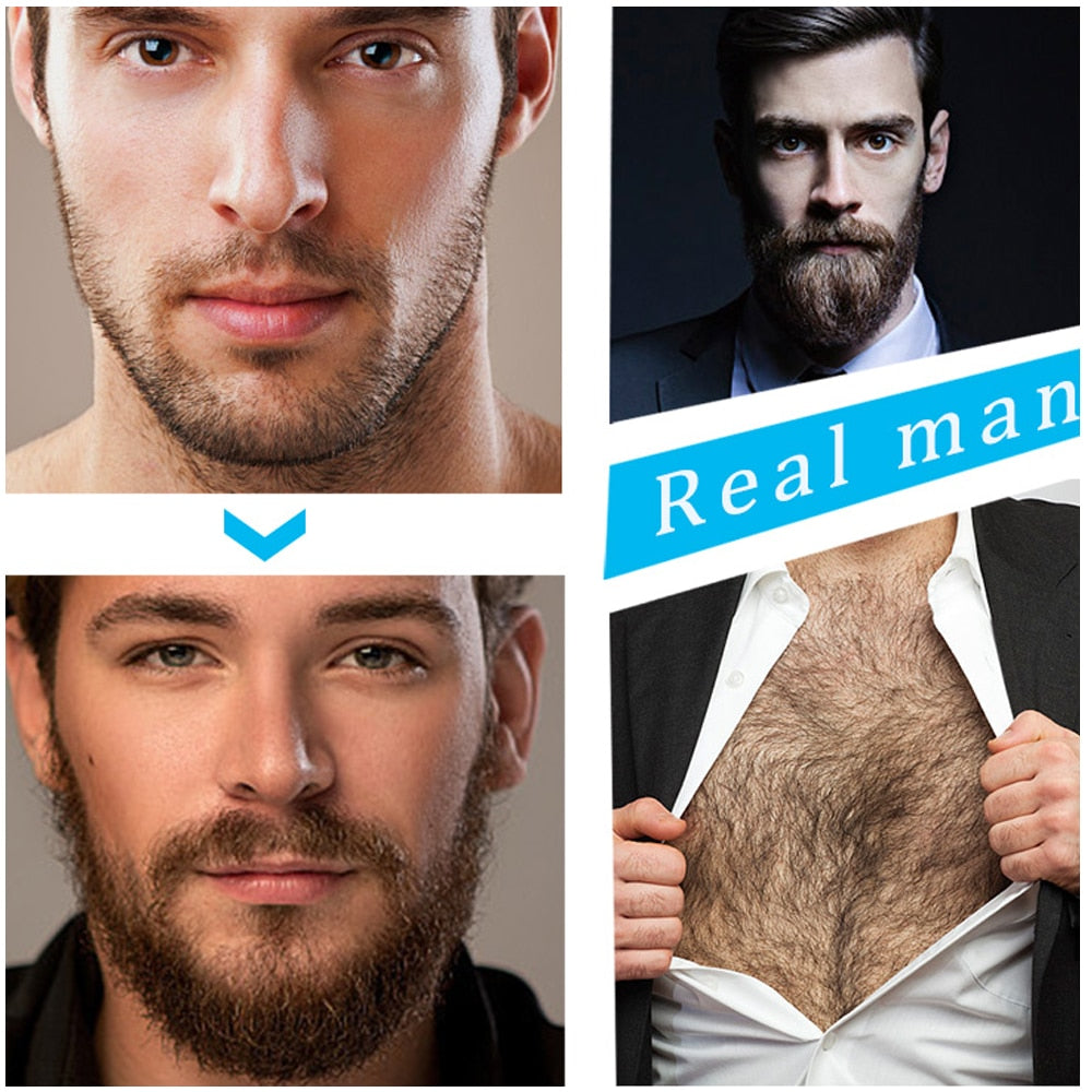 Facial Hair Growth System with Derma Roller & Natural Serum for Fuller Beard Development | Thomler
