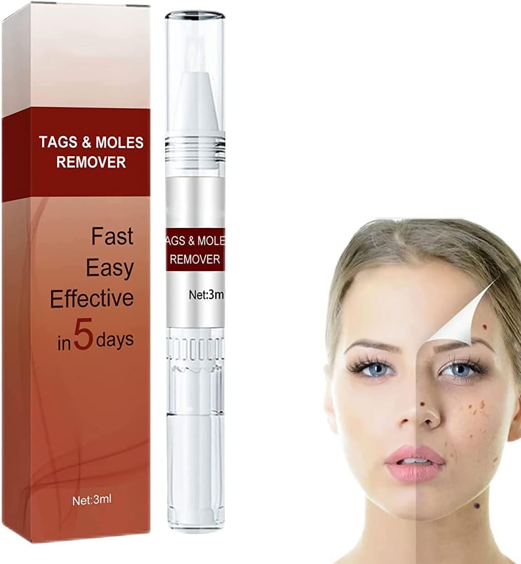 Skin Tag & Wart Removal Pen with Precision Applicator Tip for Spot Treatment at Home | Natural Plant-Based Formula | Thomler