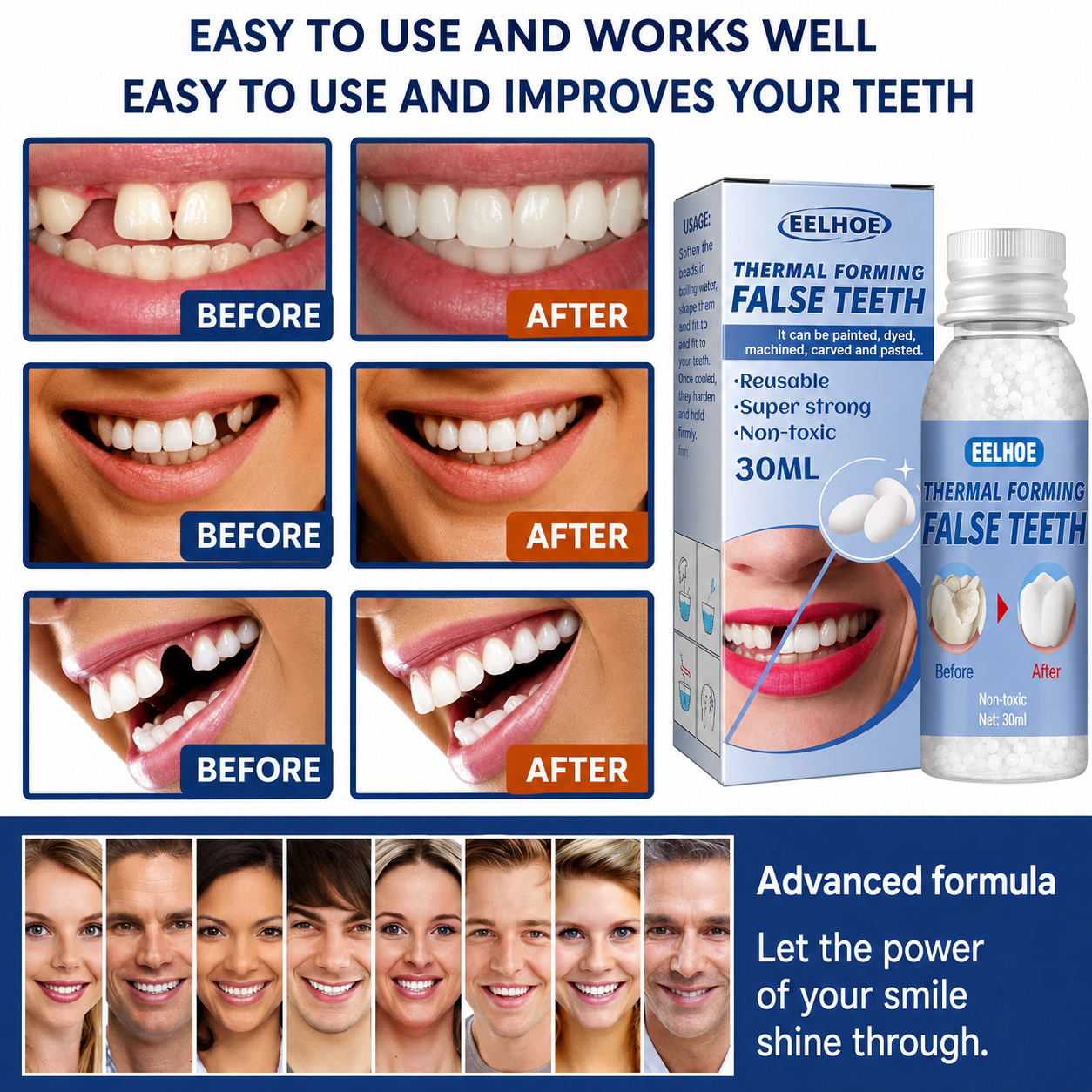 Temporary Tooth Repair Kit for Chipped Gaps Missing Teeth at Home Moldable Resin Filler Natural White Cosmetic Dental Fix Adults Kids Senior | Thomler