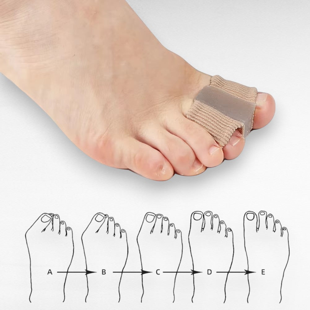 Gel Toe Spacers for Bunions, Hallux Valgus & Overlapping Toes – Soft Separator Cushions for Pain Relief & Alignment, Wearable in Shoes or | Thomler