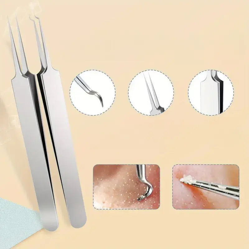 Stainless Steel Pore Extractor Tools for Acne, Clogged Pores, and Blemish Care at Home – Professional Skincare Set | Thomler