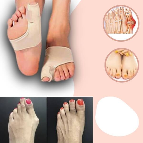 Toe Alignment Sleeve for Big Toe Joint Pain Relief – Gel Cushion Foot Corrector for Daily Comfort & Pressure Reduction – Flexible Fabric | Thomler