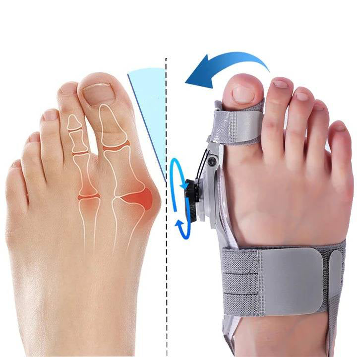Adjustable Toe Straightener with Hinge System for Hallux Valgus Relief & Foot Alignment – Silicone Spacer for Day & Night Support | Thomler