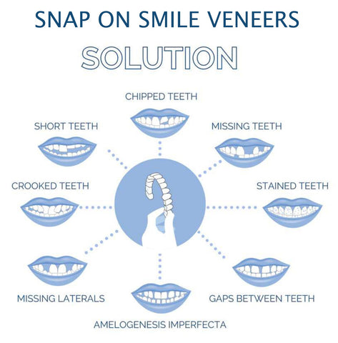 Cosmetic Tooth Covers Upper & Lower Set Instant Snap-On Dental Overlay for Natural Looking Smile Confidence Booster Reusable Teeth Caps | Thomler