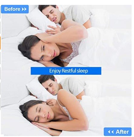Breathing Aid Nostril Vents for Better Airflow During Sleep – Medical-Grade Silicone Inserts for Nasal Congestion & Nighttime Comfort | Thomler