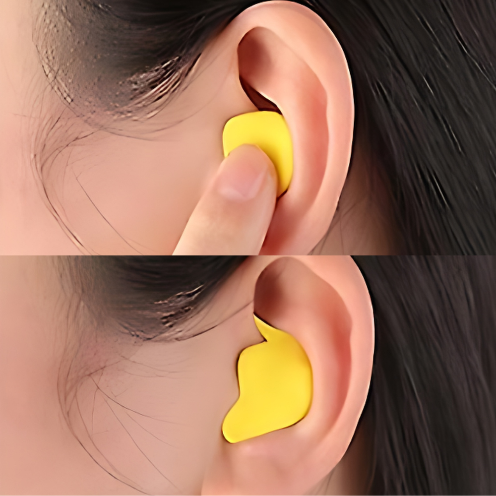 Moldable Silicone Ear Plugs for Sleeping – Reusable Noise Blocking Sleep Earplugs for Side Sleepers, Travel & Snoring | Thomler