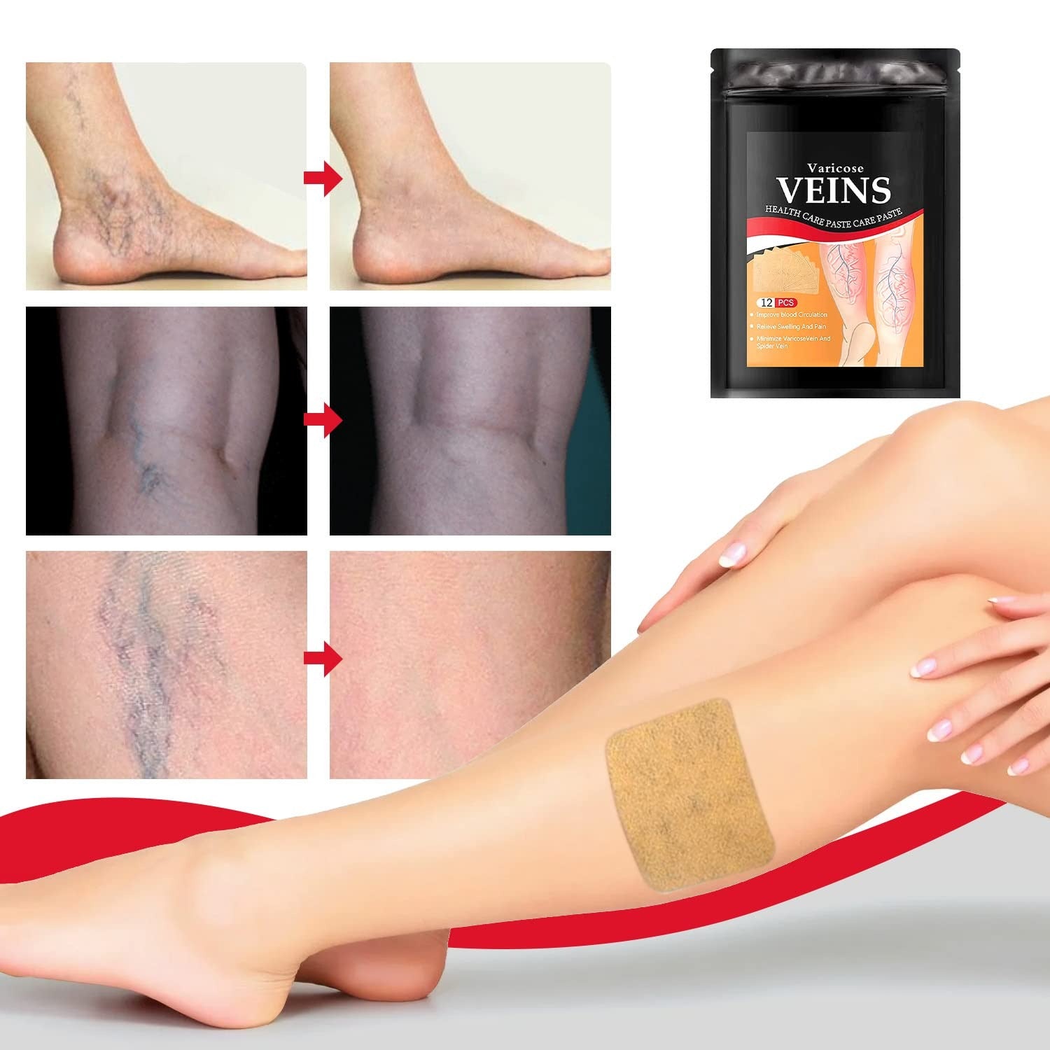 Circulation Support Patches for Legs Spider Vein Relief Swelling Reduction Botanical Formula Discreet Wear Under Clothing Post-Workout | Thomler