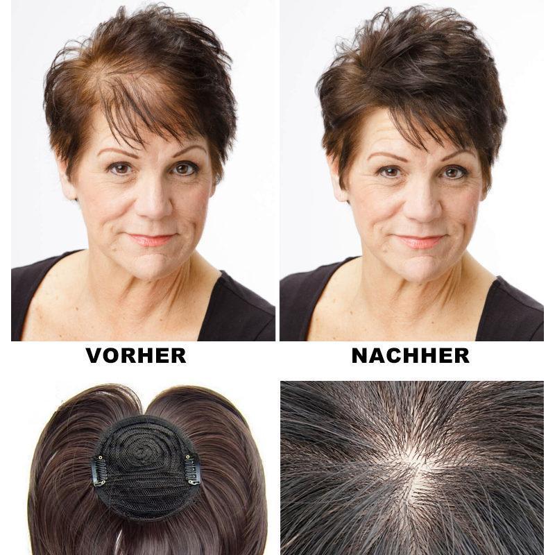 Human Hair Crown Topper Clip-In Hairpiece for Thinning Hair and Hair Loss Coverage Women's | Thomler