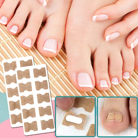 Toenail Alignment Strips for Smooth Appearance | Self-Adhesive Nail Care Patches | Easy Application for Groomed Toenails at Home | Thomler