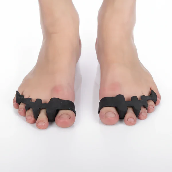 Silicone Toe Separators for Bunion Relief and Alignment Support – Reusable Gel Spacers for Hammer Toe, Yoga, Walking and Daily Comfort | Thomler