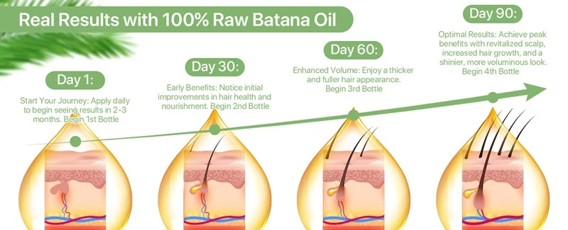 Natural Hair Growth Treatment Oil with Vitamins for Thinning Hair and Scalp Nourishment for Women and Men | Thomler