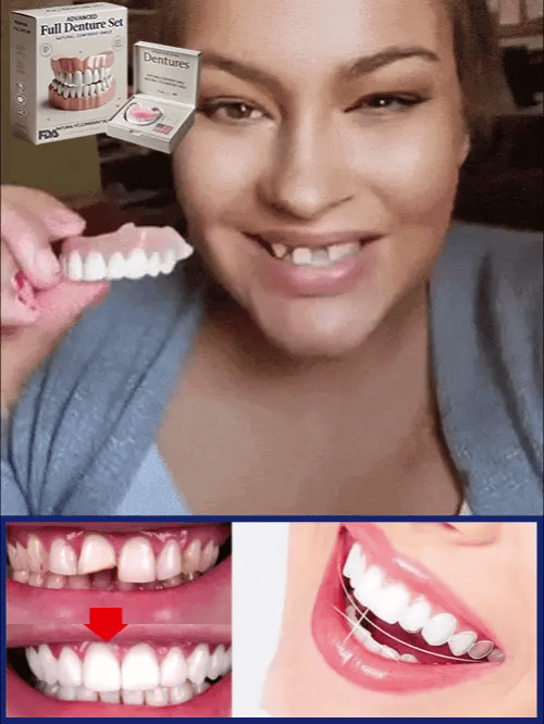 Moldable Cosmetic Denture Set Upper & Lower – Heat-Fit Natural White Teeth for Everyday Confidence | Thomler