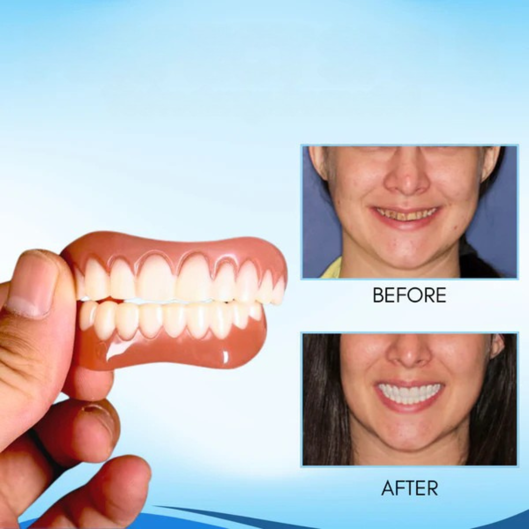 Snap-On Cosmetic Teeth Veneers - Removable Silicone Cover for Instant Smile Makeover, Photo-Ready Confidence | Thomler