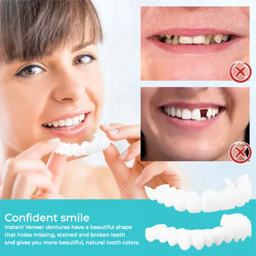 Cosmetic Tooth Veneer Snap-On Cover – Adjustable Fit for Natural-Looking Smile, Removable & Reusable Temporary Smile Enhancement | Thomler