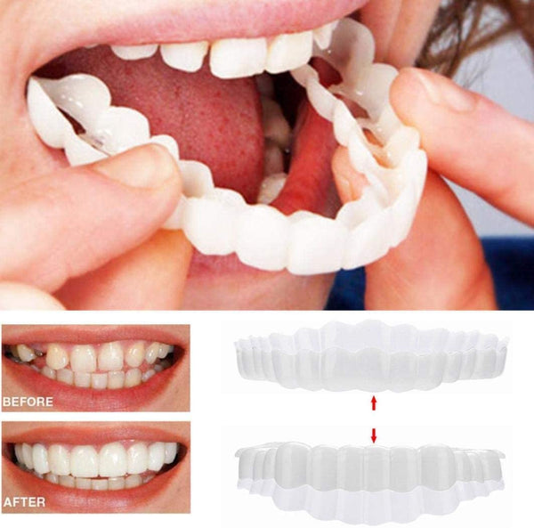 Snap-On Cosmetic Dental Veneers for Top and Bottom Teeth - Instant Smile Makeover Cover for Crooked, Stained, Missing Teeth - No Dentist Nee | Thomler