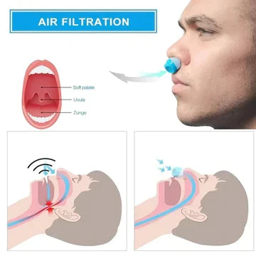 Rechargeable Micro-Fan Sleep Aid Device for Nasal Air Circulation – Cordless, Pocket-Sized Design for Travel, Camping & Hotels | Thomler