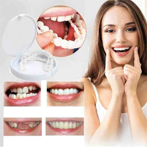 Cosmetic Tooth Veneer Snap-On Cover – Adjustable Fit for Natural-Looking Smile, Removable & Reusable Temporary Smile Enhancement | Thomler