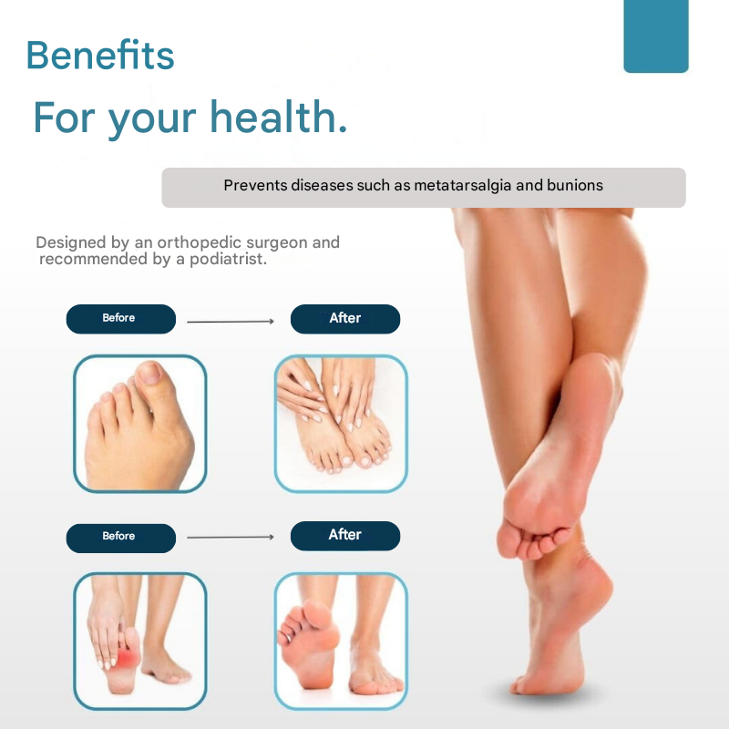 Gel Toe Spacers with Cushion Pads for Bunions & Overlapping Toes – Silicone Foot Support for Pain Relief & Realignment in Shoes or | Thomler