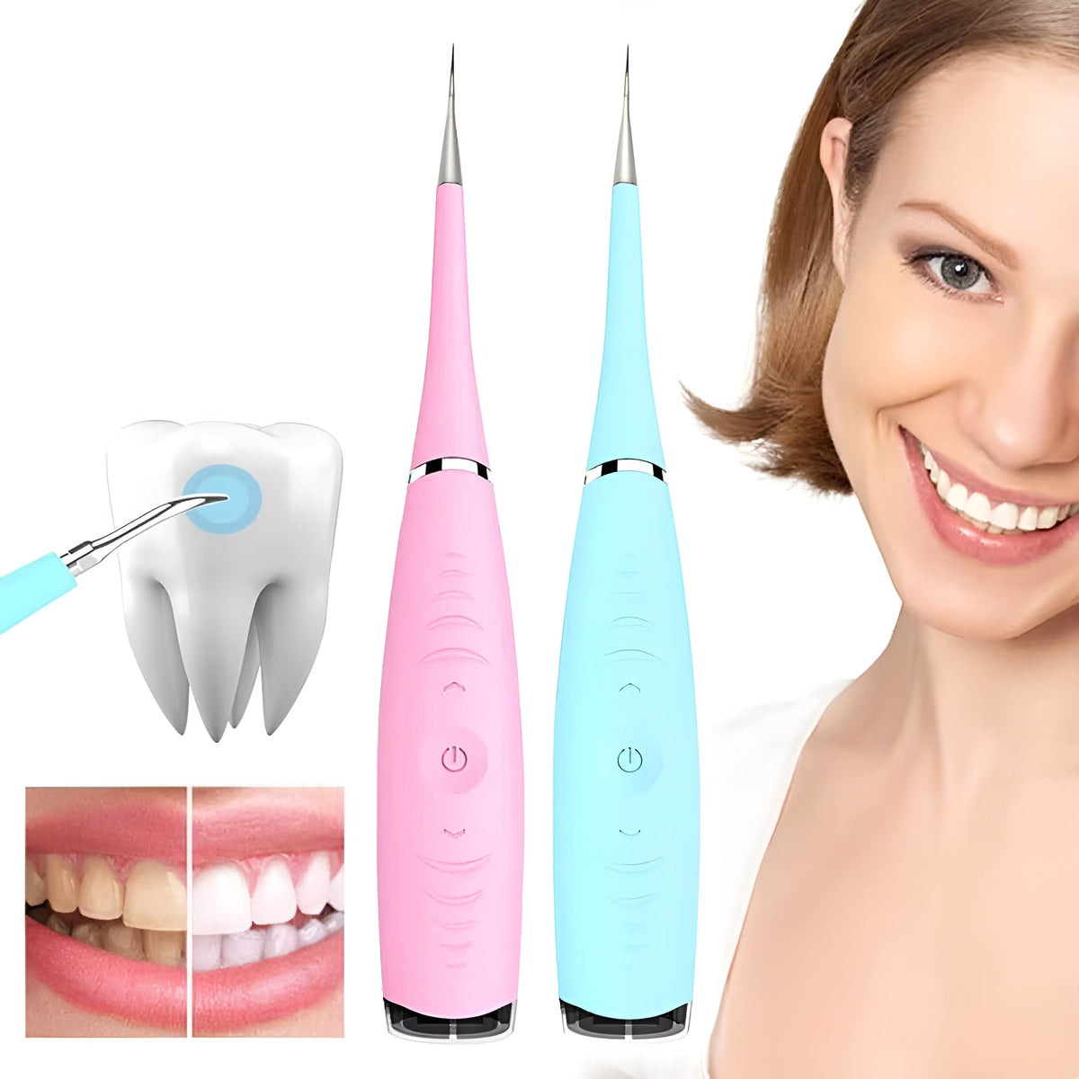 Sonic Plaque Remover for Home Teeth Cleaning & Stain Reduction | Thomler