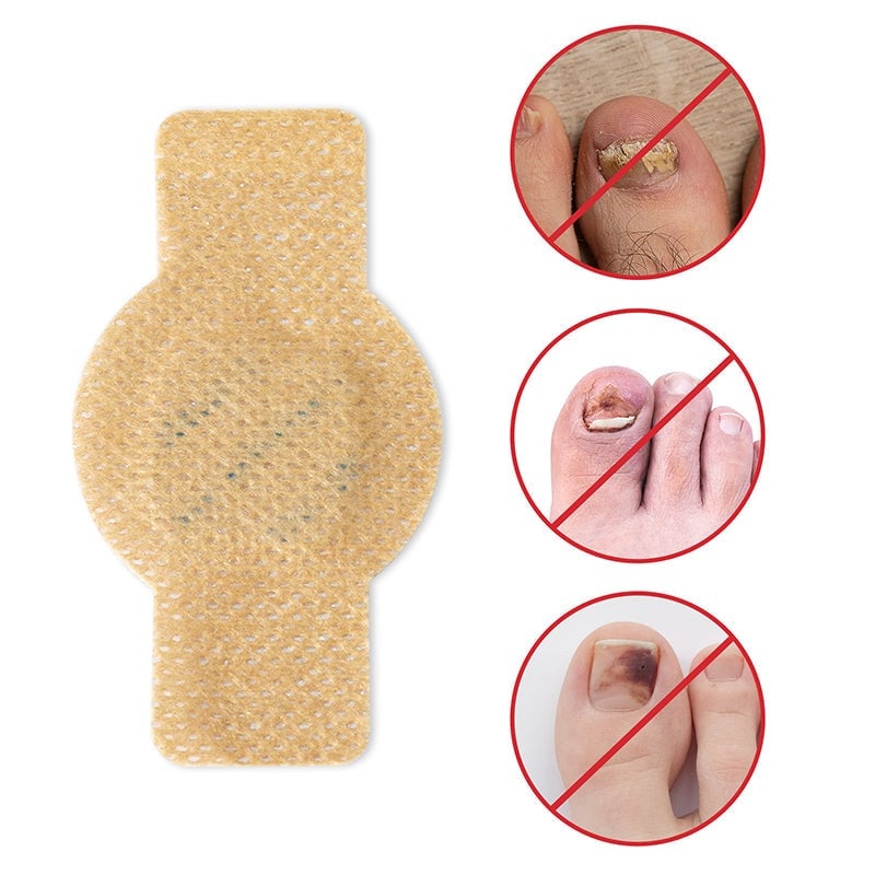 Toenail Repair Patches – Breathable Care for Discolored & Thickened Nails | Thomler