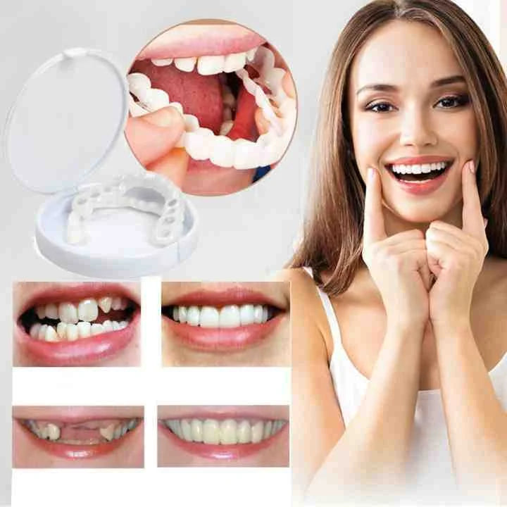 Snap-On Cosmetic Teeth Covers for Upper & Lower Teeth – Instant Smile Veneers for Missing, Broken, or Stained Teeth – Comfortable | Thomler
