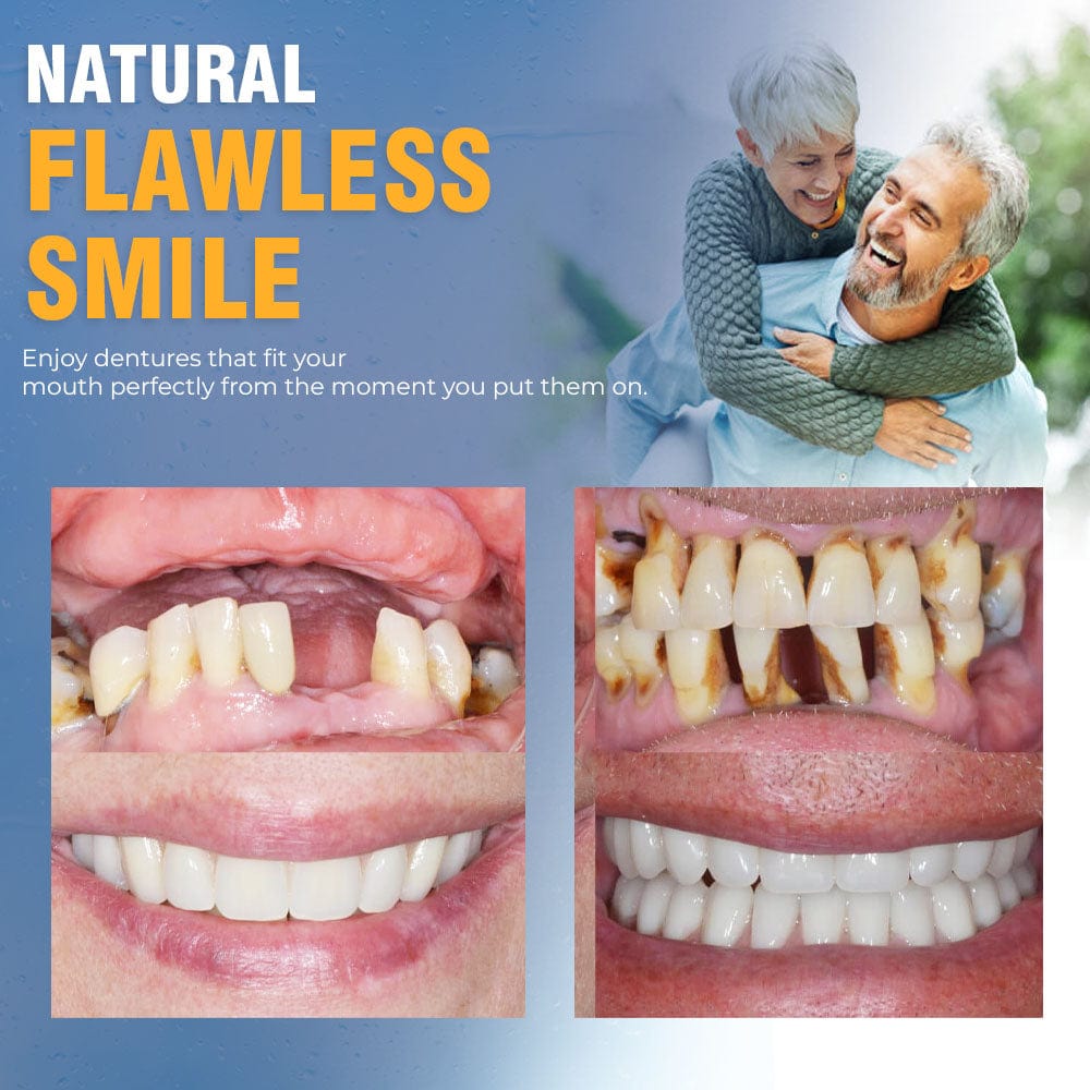 Removable Cosmetic Teeth Veneers for Adults – Instant Smile Enhancer with Silicone Liner, Reusable Snap-On Dental Cover for Natural Look | Thomler
