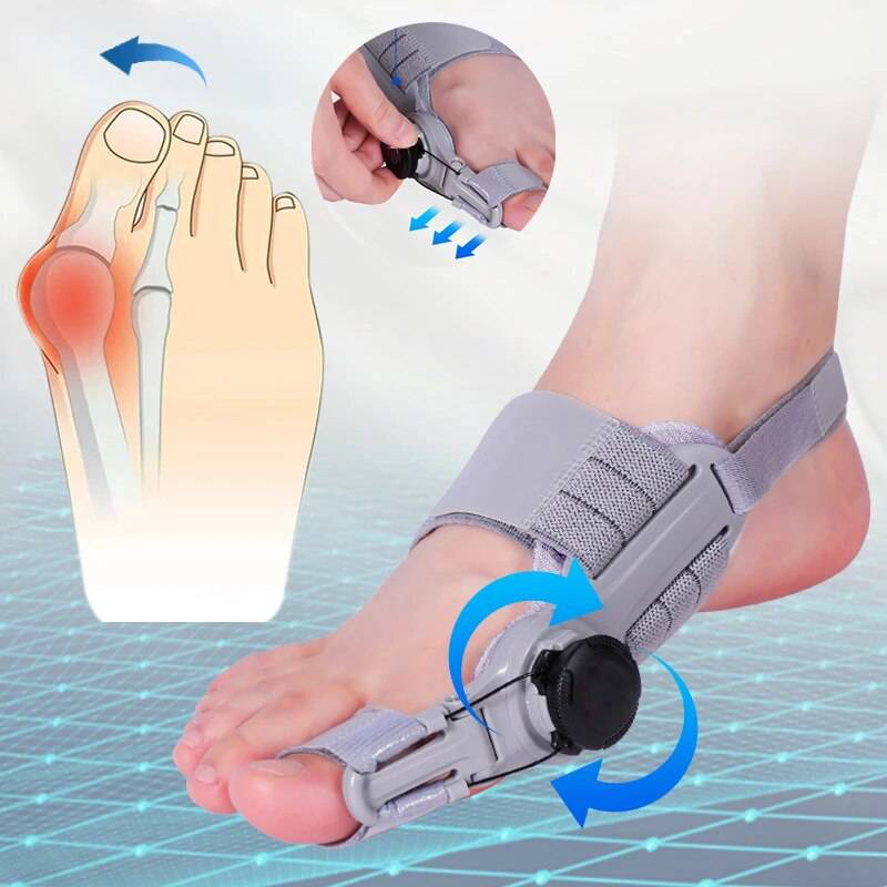 Adjustable Toe Straightener with Hinge System for Hallux Valgus Relief & Foot Alignment – Silicone Spacer for Day & Night Support | Thomler