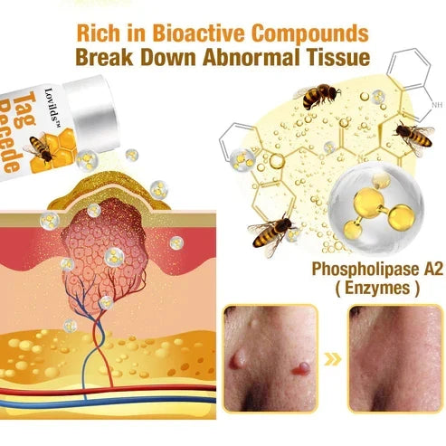 Skin Tag & Wart Removal Spray with Natural Bee Venom Extract for Blemish-Free Complexion at Home Treatment | Thomler