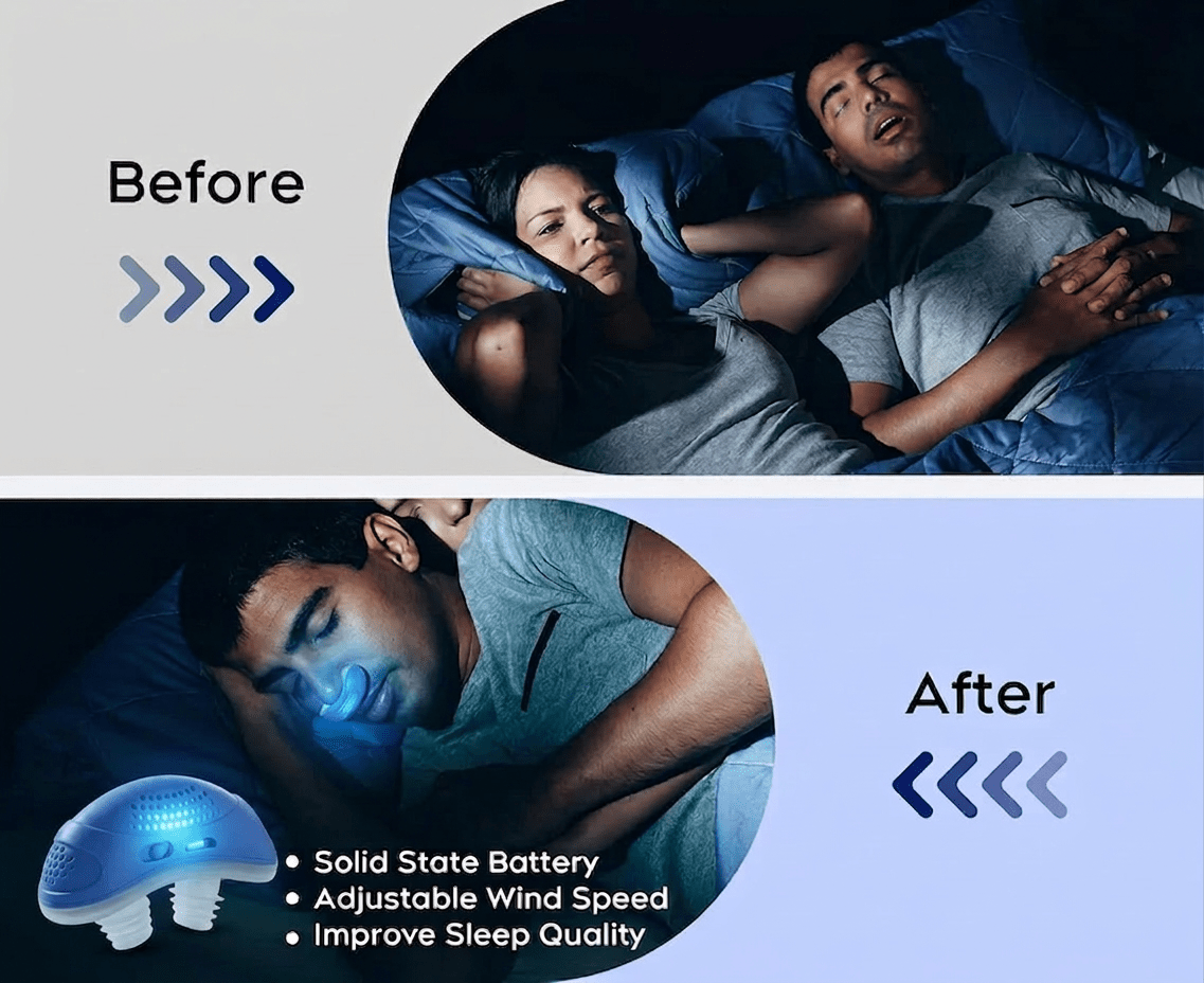 Cordless Anti-Snore Breathing Device – Compact Sleep Aid with Nasal Inserts for Nighttime Airway Support | Thomler