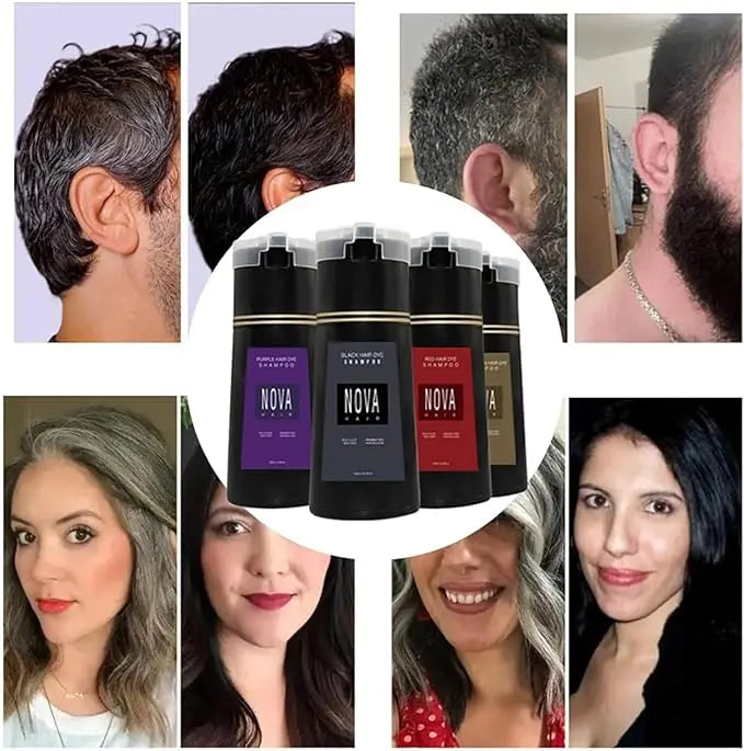 NovaHair 200 ml – Shampoo-Lösung für sofort jugendliches Haar | 1+1 GRATIS