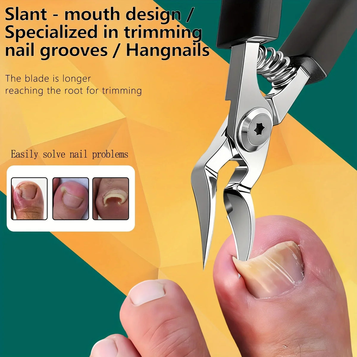 Heavy-Duty Toenail Clippers with Serrated Jaw – Precision Trimmer for Thick & Ingrown Nails, Ergonomic Steel Cutter for Men & Women | Thomler