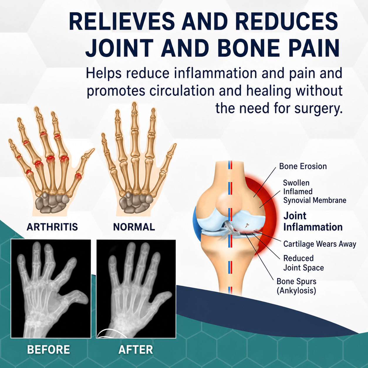 Warming Bee Venom Joint & Muscle Relief Cream for Stiffness & Discomfort Deep Massage Therapy Herbal Topical Balm for Knee Back Shoulder Nec | Thomler