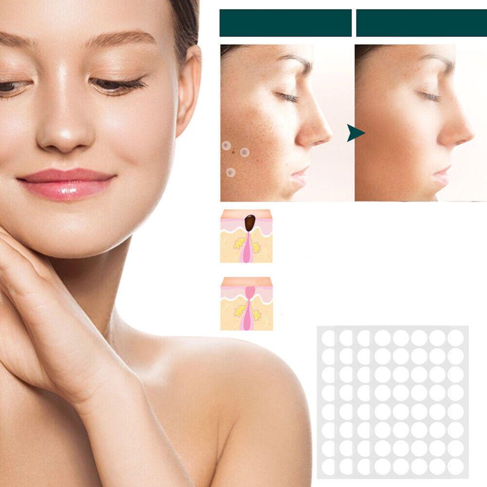 Hydrocolloid Skin Tag & Wart Remover Patches 120-Pack | Gentle Spot Treatment for Home Use | Invisible Adhesive Discs with Tea Tree Oil for | Thomler