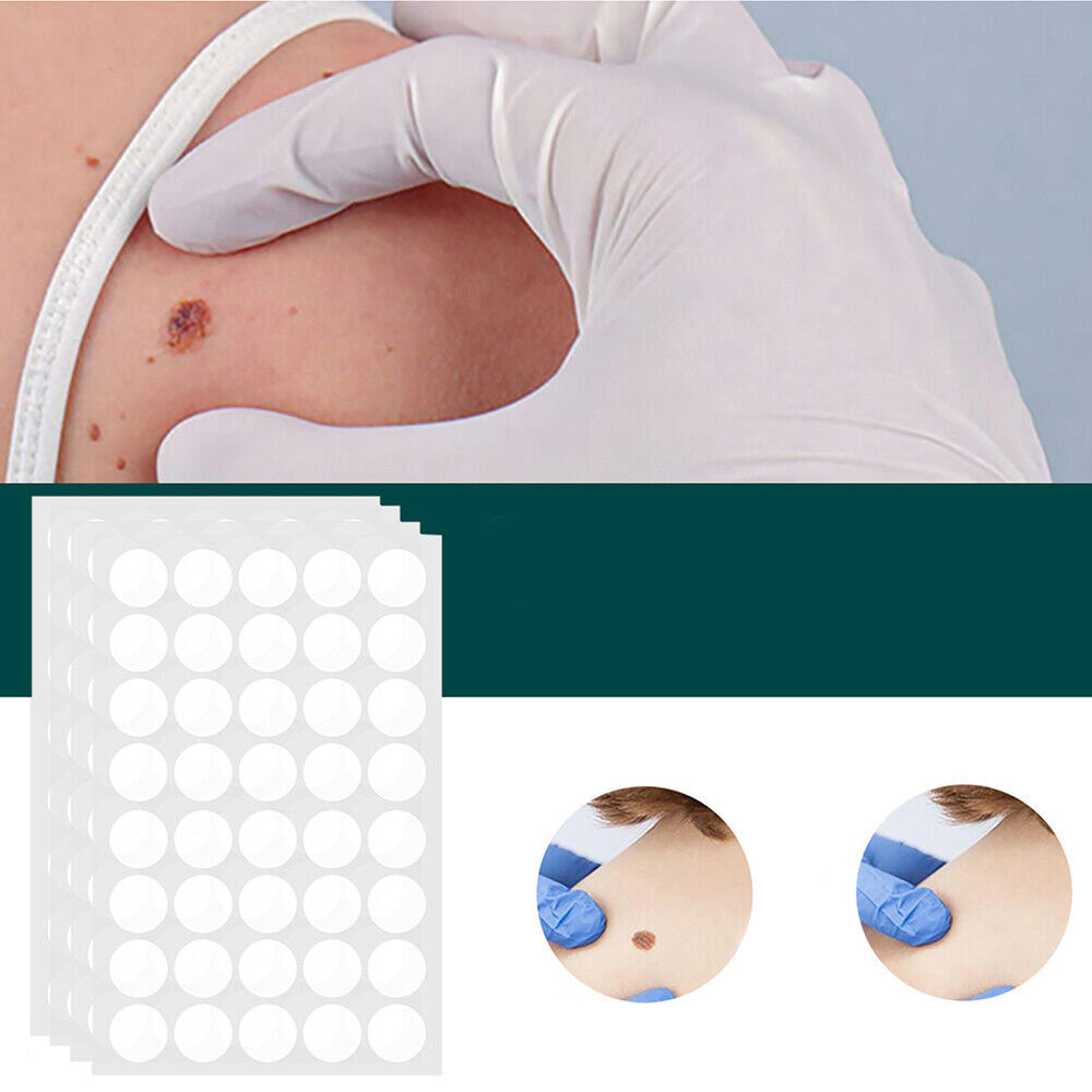 Hydrocolloid Skin Tag & Wart Remover Patches 120-Pack | Gentle Spot Treatment for Home Use | Invisible Adhesive Discs with Tea Tree Oil for | Thomler