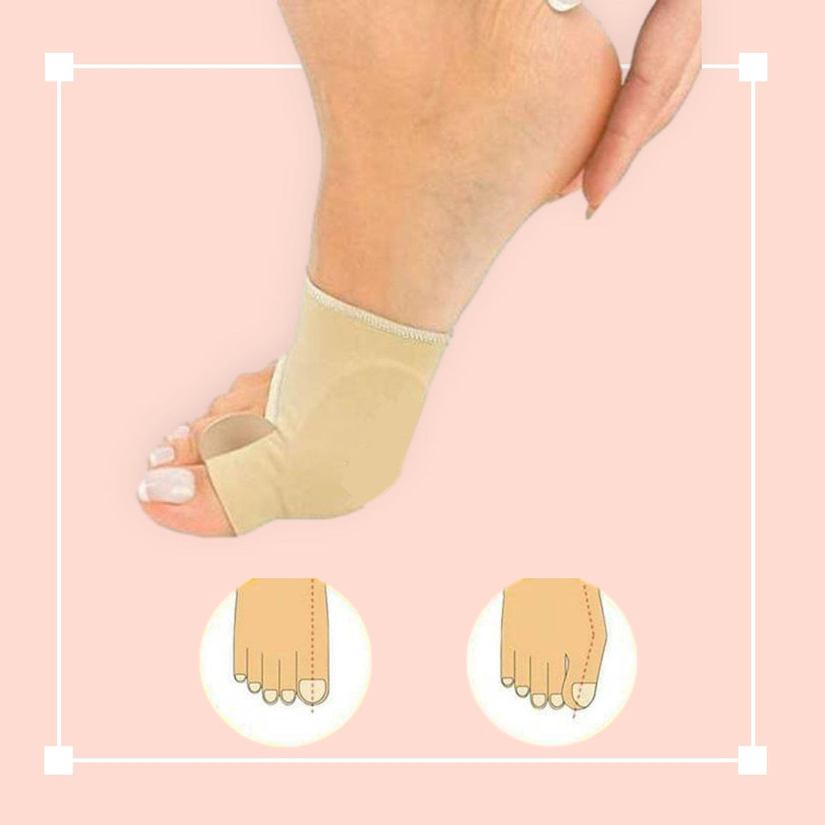 Soft Gel Toe Spacer Sleeve for Bunion & Hammertoe Relief – Cushioned Alignment Support for Daily Wear | Thomler