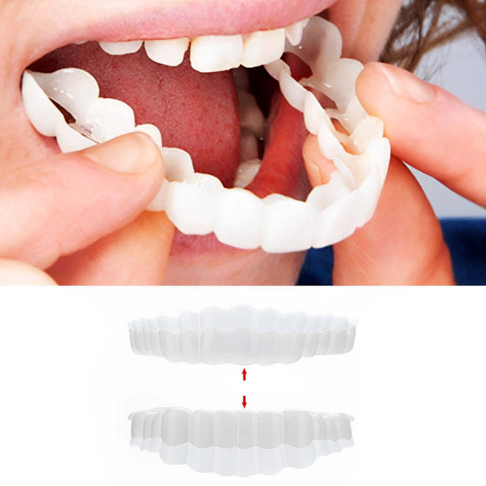 Cosmetic Tooth Covers Upper & Lower Set Instant Snap-On Dental Overlay for Natural Looking Smile Confidence Booster Reusable Teeth Caps | Thomler