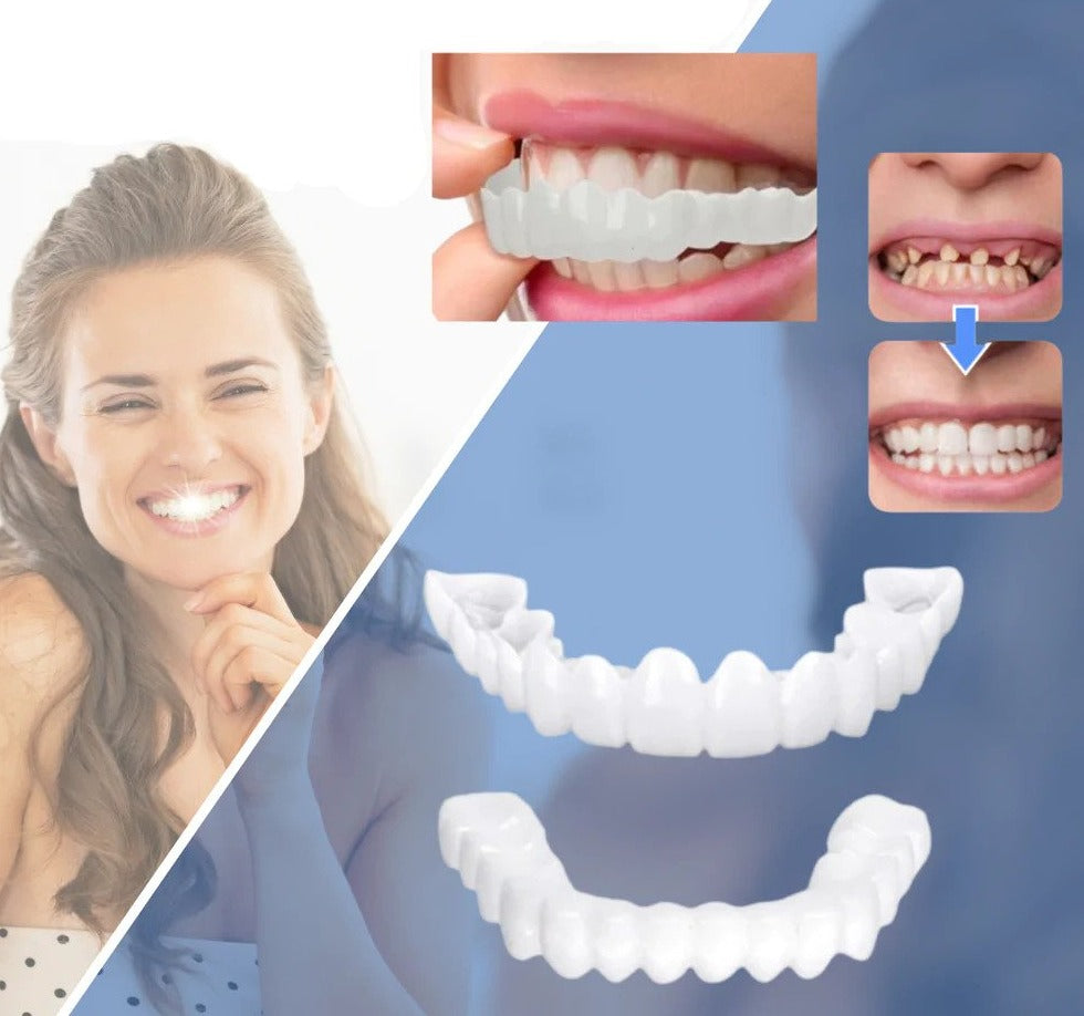Snap-On Cosmetic Veneers for Teeth | Instant Smile Enhancement | No Adhesive Required | Flexible Reusable Dental Covers for Eating, Drinking | Thomler