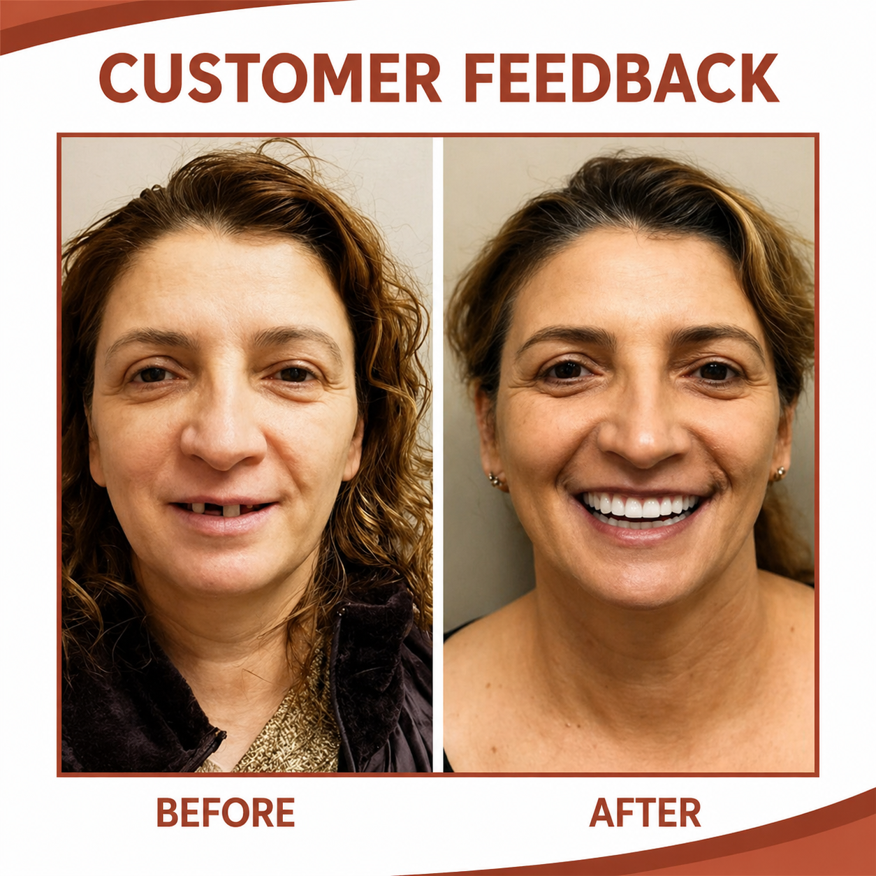 Soft Silicone Denture Cushion Liner for Comfortable Fit Without Pain or Slipping | Easy Home Application | Upper & Lower Arch Support | Thomler