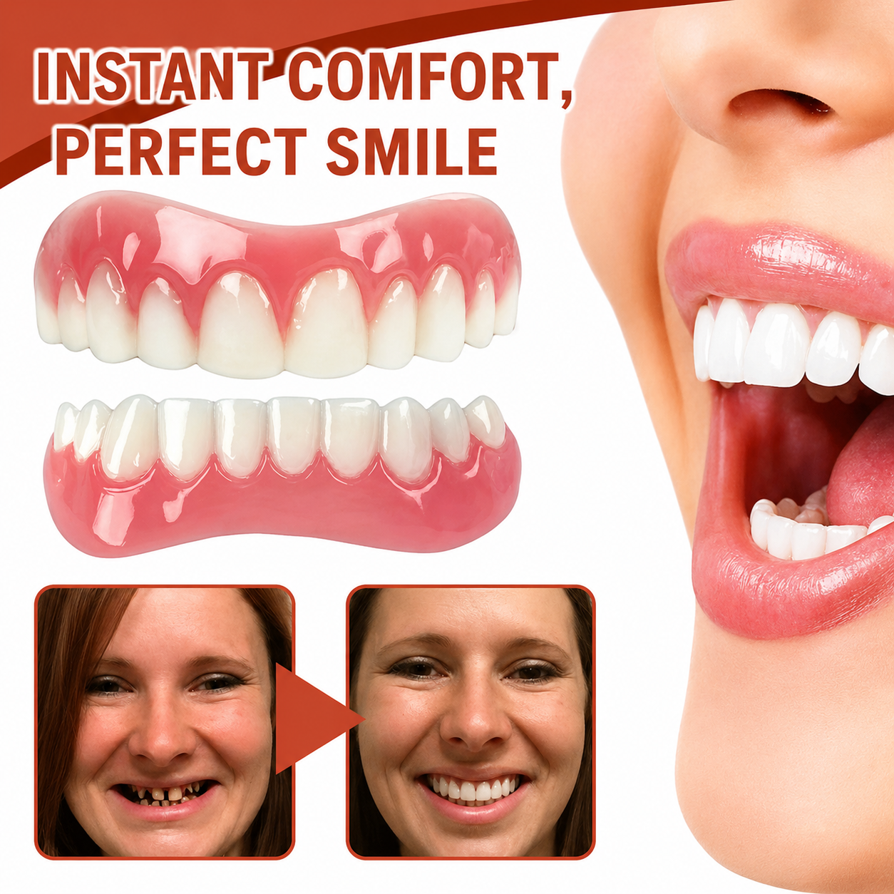 Soft Silicone Denture Cushion Liner for Comfortable Fit Without Pain or Slipping | Easy Home Application | Upper & Lower Arch Support | Thomler