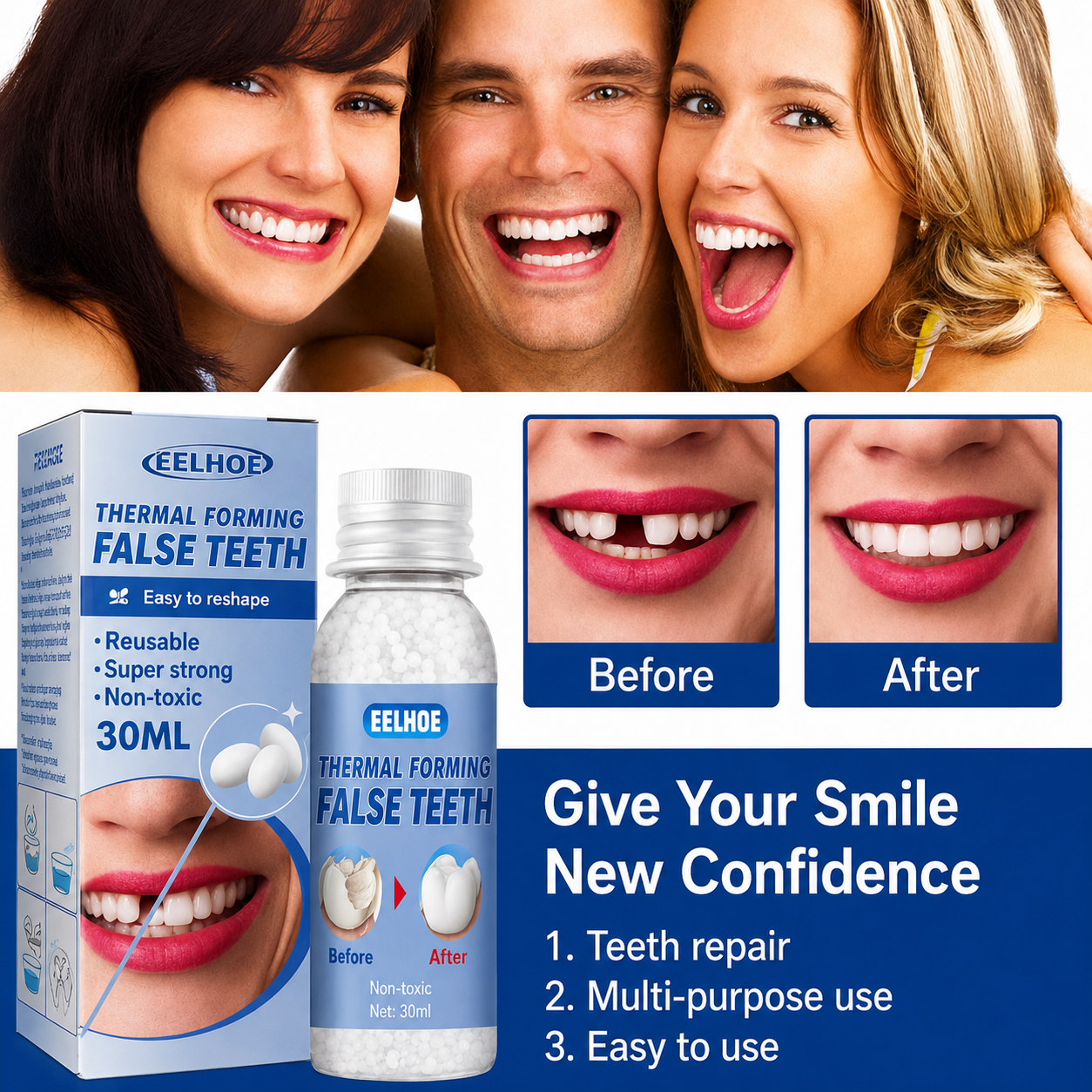 Temporary Tooth Repair Kit for Chipped Gaps Missing Teeth at Home Moldable Resin Filler Natural White Cosmetic Dental Fix Adults Kids Senior | Thomler